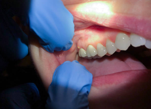 Best Broken or Chipped Tooth Repair in Pottsville, AR